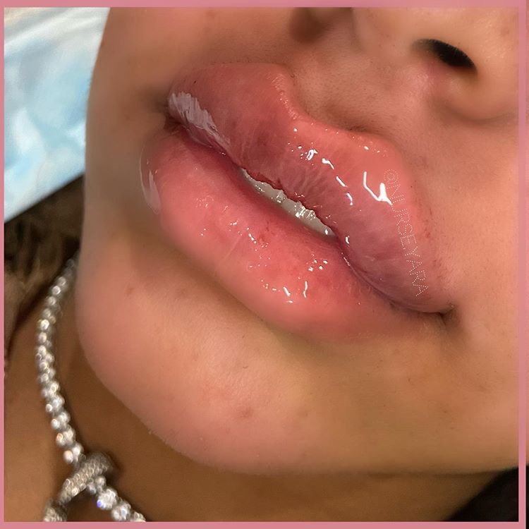 Nurse Yara work 2