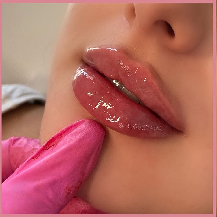 Nurse Yara work 5